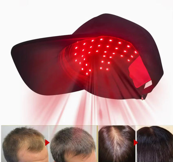 Biovital Hair Growth Cap | Red Light Therapy for Hair Regrowth